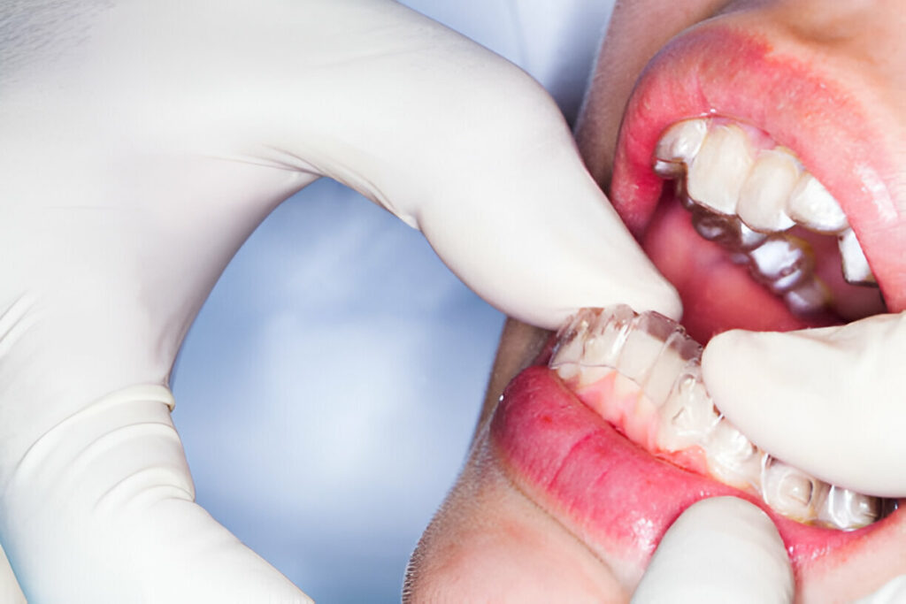 The Best Dentists in Keller for Cosmetic Dentistry: What Sets Keller Family Dental Apart_2