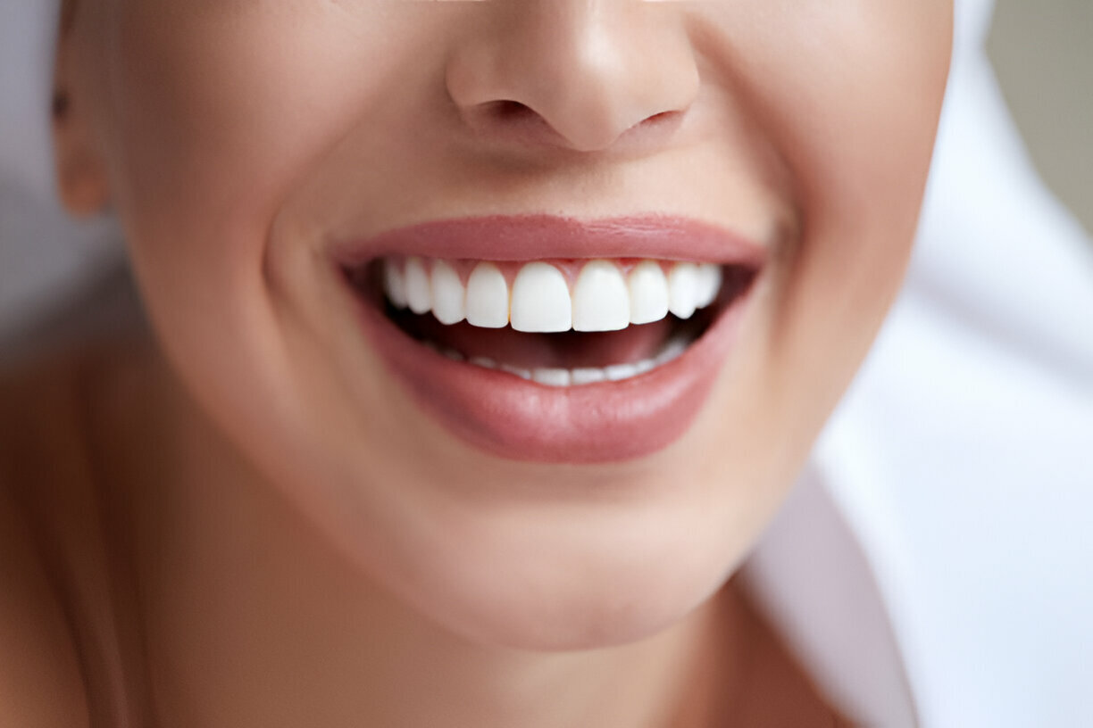 The Best Dentists in Keller for Cosmetic Dentistry: What Sets Keller Family Dental Apart_FI