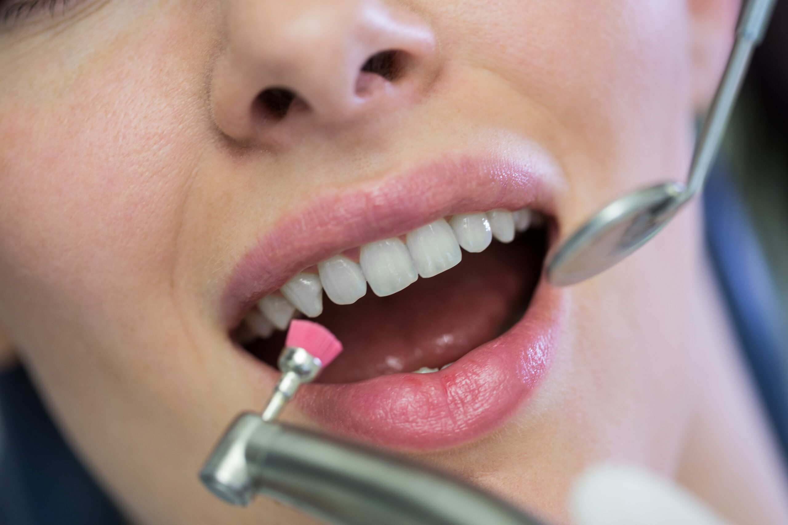 Why Regular Dental Cleanings Matter: Expert Care from Keller Family Dental in Keller, TX_FI