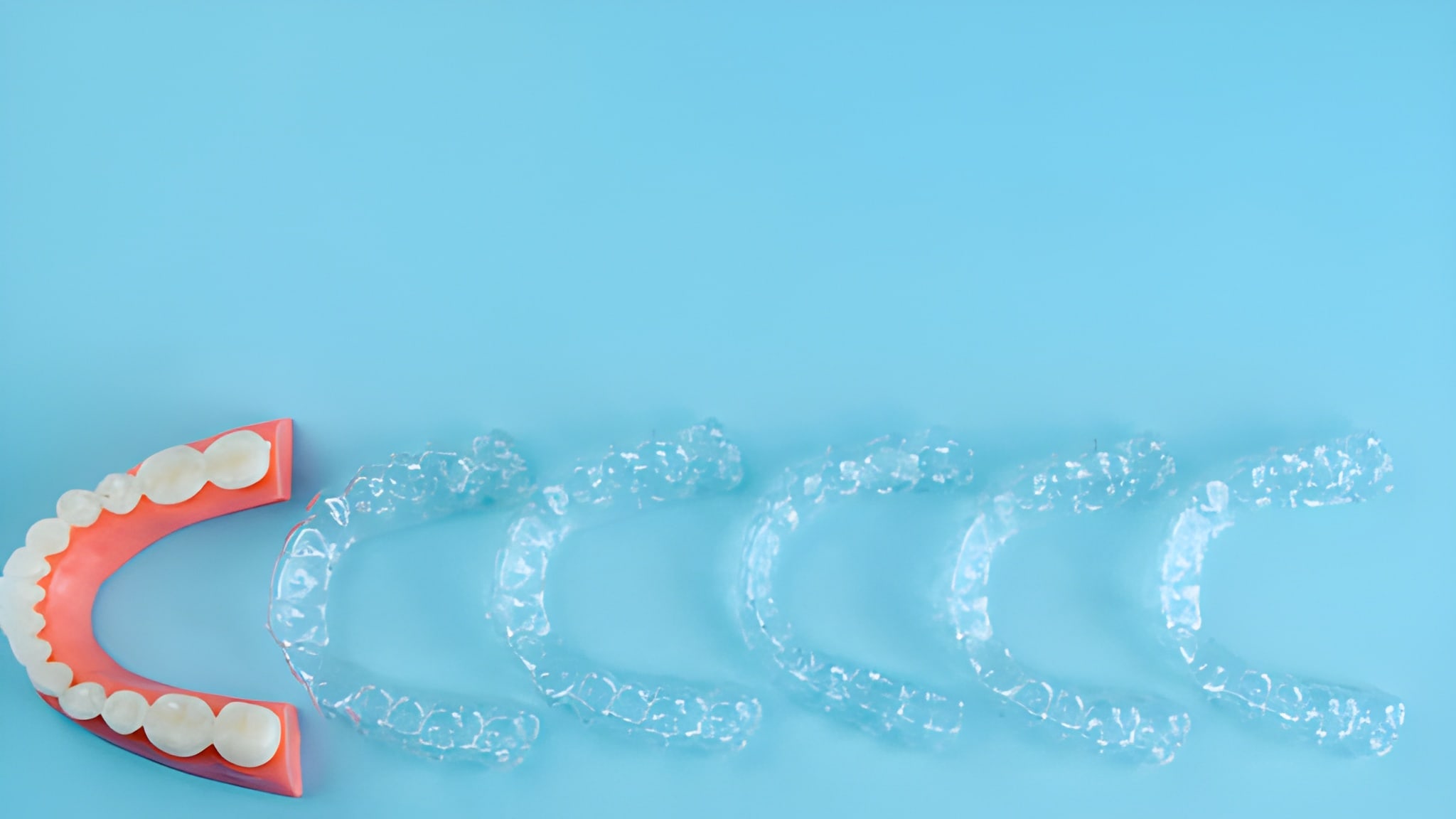 Invisalign for Teens & Adults in Keller, TX: What to Expect_FI